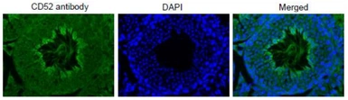 Anti-CD52 antibody used in IHC (Paraffin sections) (IHC-P). GTX00743