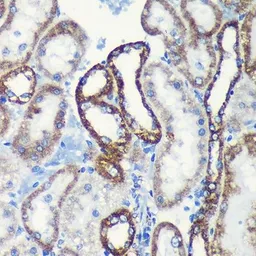 Anti-TOMM20 antibody [GT1136] used in IHC (Paraffin sections) (IHC-P). GTX00773
