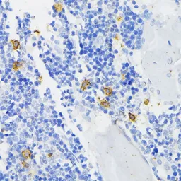 Anti-NOX2 / gp91phox antibody used in IHC (Paraffin sections) (IHC-P). GTX00785