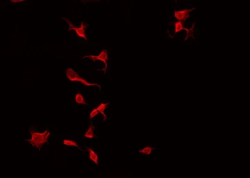 Anti-TIE2 (phospho Ser1119) antibody used in Immunocytochemistry/ Immunofluorescence (ICC/IF). GTX00793