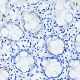 Anti-HIF1 beta antibody [GT1141] used in IHC (Paraffin sections) (IHC-P). GTX00799