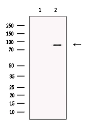 Anti-MARK4 antibody used in Western Blot (WB). GTX00800