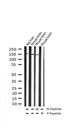 Anti-TrkB (phospho Tyr515) antibody used in Western Blot (WB). GTX00804