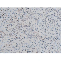 Anti-ATF2 (phospho Thr69) antibody used in IHC (Paraffin sections) (IHC-P). GTX00805