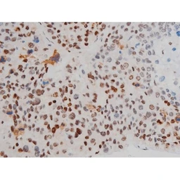 Anti-ATF2 (phospho Thr69) antibody used in IHC (Paraffin sections) (IHC-P). GTX00805