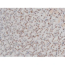 Anti-ATF2 (phospho Thr69) antibody used in IHC (Paraffin sections) (IHC-P). GTX00805