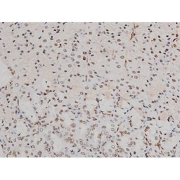 Anti-ATF2 (phospho Thr69) antibody used in IHC (Paraffin sections) (IHC-P). GTX00805