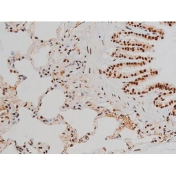 Anti-ATF2 (phospho Thr69) antibody used in IHC (Paraffin sections) (IHC-P). GTX00805