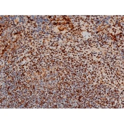 Anti-ATF2 (phospho Thr69) antibody used in IHC (Paraffin sections) (IHC-P). GTX00805