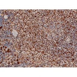 Anti-ATF2 (phospho Thr69) antibody used in IHC (Paraffin sections) (IHC-P). GTX00805