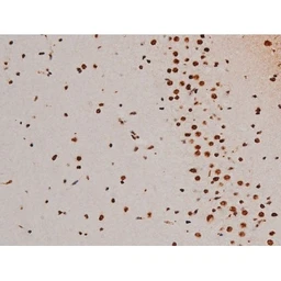 Anti-ATF2 (phospho Thr69) antibody used in IHC (Paraffin sections) (IHC-P). GTX00805