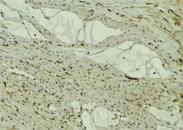 Anti-FBXO32 antibody used in IHC (Paraffin sections) (IHC-P). GTX00810