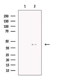 Anti-FBXO32 antibody used in Western Blot (WB). GTX00810