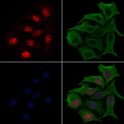 Anti-RUNX2 (phospho Ser275) antibody used in Immunocytochemistry/ Immunofluorescence (ICC/IF). GTX00813