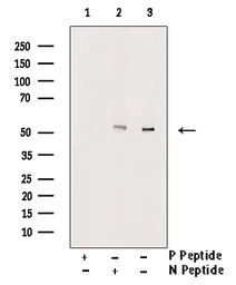 Anti-RUNX2 (phospho Ser275) antibody used in Western Blot (WB). GTX00813