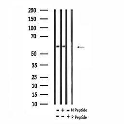 Anti-RUNX2 (phospho Ser275) antibody used in Western Blot (WB). GTX00813