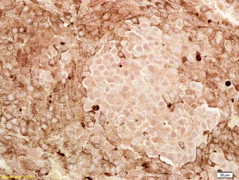 Anti-CITED1 antibody used in IHC (Paraffin sections) (IHC-P). GTX00820