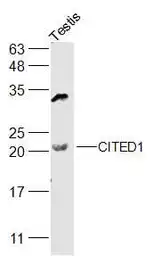 Anti-CITED1 antibody used in Western Blot (WB). GTX00820