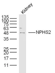 Anti-NPHS2 antibody used in Western Blot (WB). GTX00821