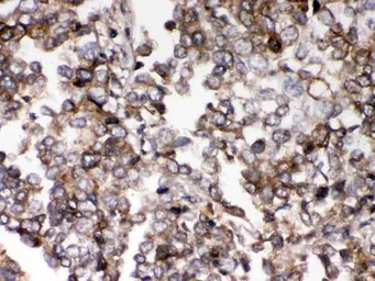 Anti-AIM2 antibody used in IHC (Paraffin sections) (IHC-P). GTX00830