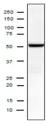 Anti-Influenza A virus Nucleoprotein antibody [C43] used in Western Blot (WB). GTX00858