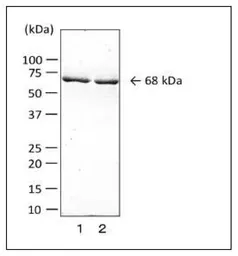 Anti-Clostridium perfringens Collagenase antibody [cp-02] used in Western Blot (WB). GTX00865