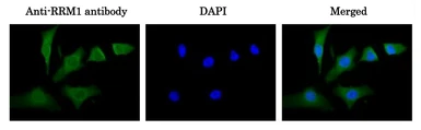 Anti-RRM1 antibody used in Immunocytochemistry/ Immunofluorescence (ICC/IF). GTX00883