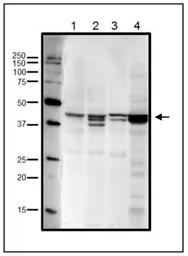 Anti-RRM2 antibody used in Western Blot (WB). GTX00888
