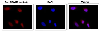 Anti-GRWD1 antibody used in Immunocytochemistry/ Immunofluorescence (ICC/IF). GTX00895