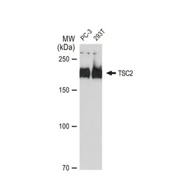 Anti-TSC2 antibody [GT1147] used in Western Blot (WB). GTX00917