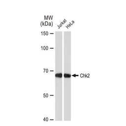 Anti-Chk2 antibody [GT1148] used in Western Blot (WB). GTX00927