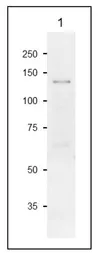 Anti-Sucrose-Phosphate Synthase antibody used in Western Blot (WB). GTX00931