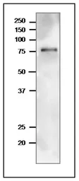 Anti-TGG1 / Myrosinase 1 antibody used in Western Blot (WB). GTX00932