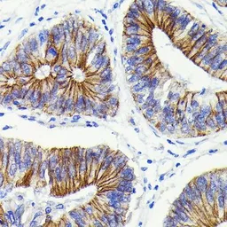 Anti-beta Catenin antibody [GT1186] used in IHC (Paraffin sections) (IHC-P). GTX00948