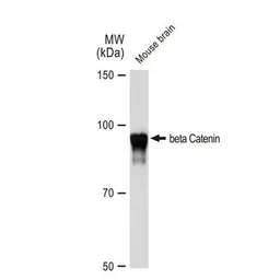 Anti-beta Catenin antibody [GT1186] used in Western Blot (WB). GTX00948