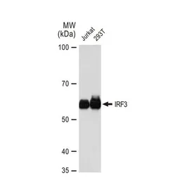 Anti-IRF3 antibody [GT1194] used in Western Blot (WB). GTX00956
