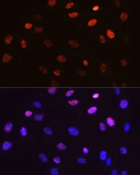 Anti-c-Jun (phospho Ser63) antibody [GT1198] used in Immunocytochemistry/ Immunofluorescence (ICC/IF). GTX00960