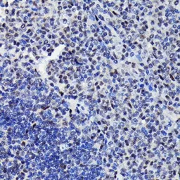 Anti-STAT3 (phospho Ser727) antibody [GT1206] used in IHC (Paraffin sections) (IHC-P). GTX00968