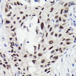 Anti-STAT3 (phospho Ser727) antibody [GT1206] used in IHC (Paraffin sections) (IHC-P). GTX00968