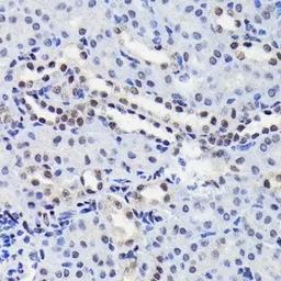 Anti-STAT3 (phospho Ser727) antibody [GT1206] used in IHC (Paraffin sections) (IHC-P). GTX00968