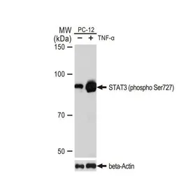 Anti-STAT3 (phospho Ser727) antibody [GT1206] used in Western Blot (WB). GTX00968