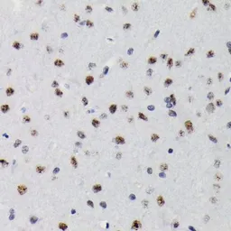 Anti-SMAD3 (phospho Ser423/Ser425) antibody [GT1207] used in IHC (Paraffin sections) (IHC-P). GTX00969