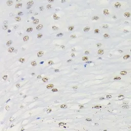 Anti-SMAD3 (phospho Ser423/Ser425) antibody [GT1207] used in IHC (Paraffin sections) (IHC-P). GTX00969