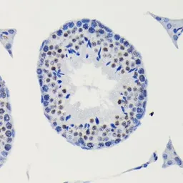 Anti-SMAD3 (phospho Ser423/Ser425) antibody [GT1207] used in IHC (Paraffin sections) (IHC-P). GTX00969