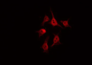 Anti-BCOR antibody used in Immunocytochemistry/ Immunofluorescence (ICC/IF). GTX01027