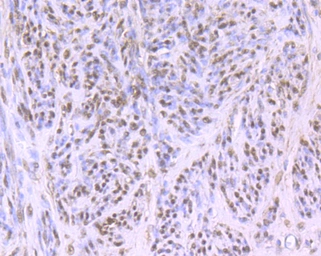 Anti-Cullin 4a antibody [JU07-33] used in IHC (Paraffin sections) (IHC-P). GTX01050