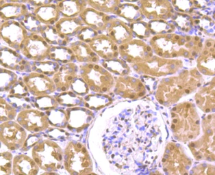 Anti-Cullin 4a antibody [JU07-33] used in IHC (Paraffin sections) (IHC-P). GTX01050