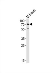 Anti-HAS2 antibody used in Western Blot (WB). GTX01068