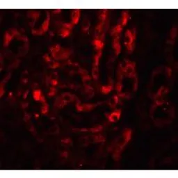 Anti-IL17A antibody used in IHC (Paraffin sections) (IHC-P). GTX01094