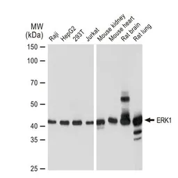 Anti-ERK1 antibody [GT1156] used in Western Blot (WB). GTX01099